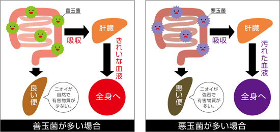 善玉菌が多い場合と悪玉菌が多い場合